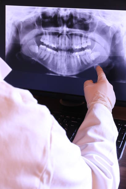 Best Emergency Dental Services for Seniors in Lewistown, PA